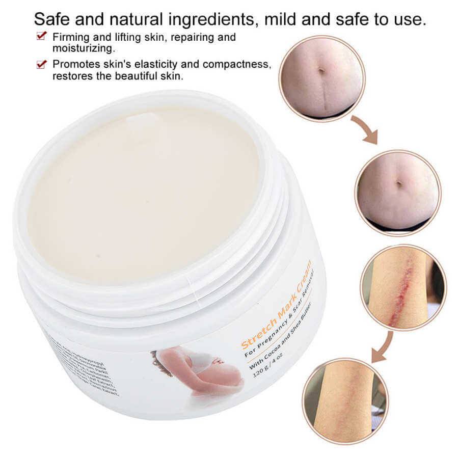 Melao Stretch Mark Cream 120g - 5