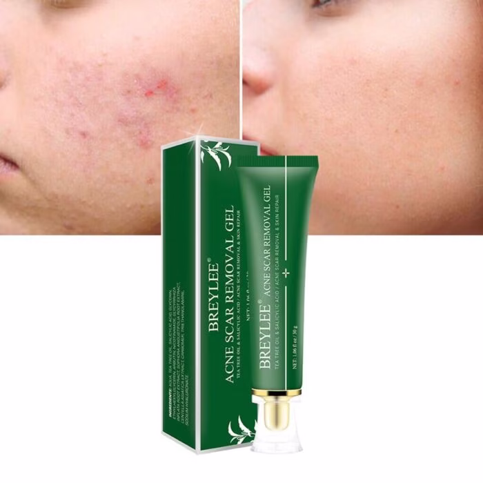 BREYLEE Tea Tree Acne Scar Removal Gel - 3