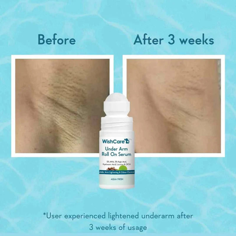 WishCare Under Arm Roll On Serum 50ml - 2