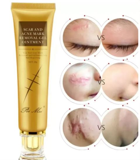 TCM Scar And Acne Mark Removal Gel Ointment  ৳550 ৳380 - 4