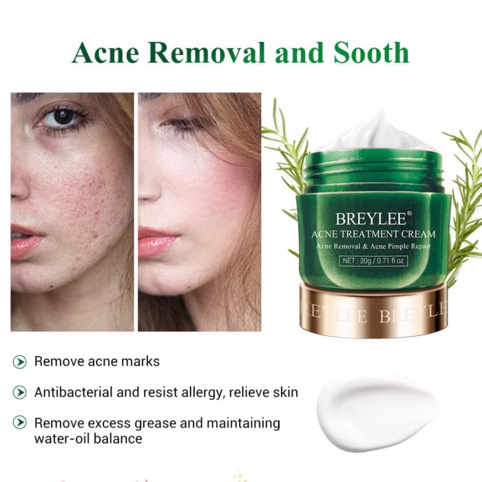 BREYLEE Acne Treatment Cream - 3