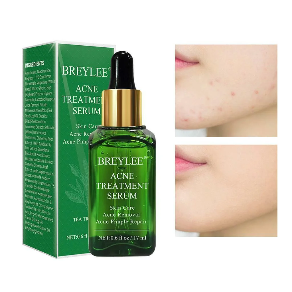 Acne Treatment Serum - 4